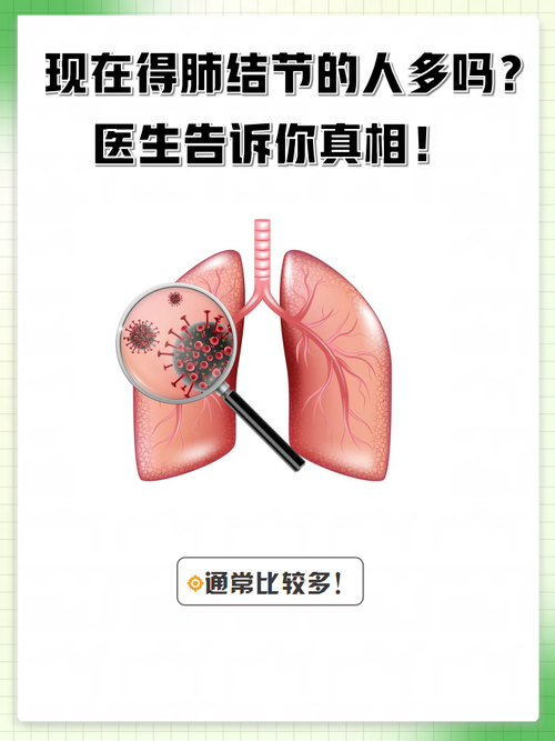 男子查出557个肺结节,其中26个高危!医生:每一个都像地雷……