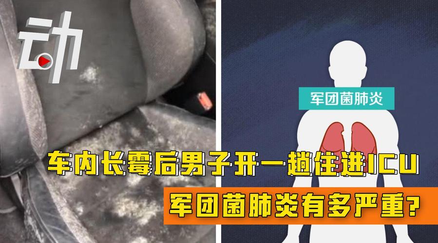 海南一女子被鱼咬了一下竟住进ICU,跟这种细菌有关→