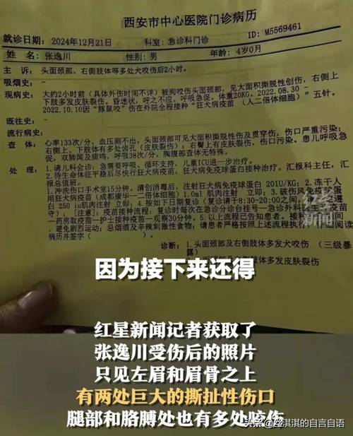 四川平昌县通报:3名小孩放擦火炮炸飞多个井盖,1人轻微擦伤