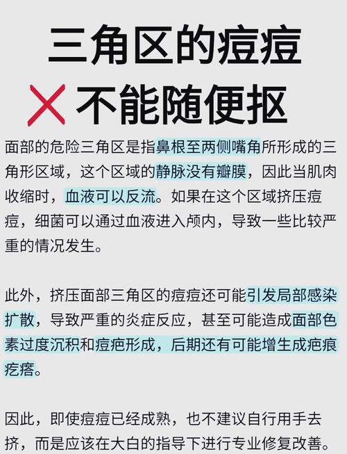 长期挤痘痘有哪些危害?忍不住想挤时可以这样做